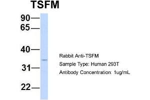 Host: Rabbit Target Name: TSFM Sample Type: Human 293T Antibody Dilution: 1. (TSFM anticorps  (Middle Region))
