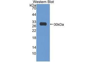 WB of Protein Standard: different control antibodies against Highly purified E. (Ki-67 Kit ELISA)