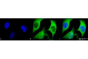 Immunocytochemistry/Immunofluorescence analysis using Mouse Anti-Ubiquitin Monoclonal Antibody, Clone 5B9-B3 . (Ubiquitin anticorps  (FITC))