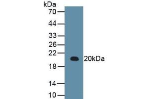 Detection of Recombinant RARS, Human using Monoclonal Antibody to Arginyl tRNA Synthetase (RARS)