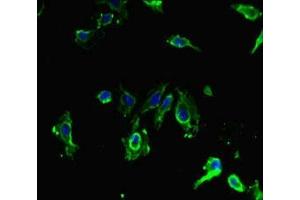 Immunofluorescent analysis of Hela cells using ABIN7169707 at dilution of 1:100 and Alexa Fluor 488-congugated AffiniPure Goat Anti-Rabbit IgG(H+L)