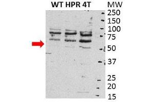 SRC antibody - N-terminal region  validated by WB using total cell lysate from human ovarian carcinoma cells at 1:1000.