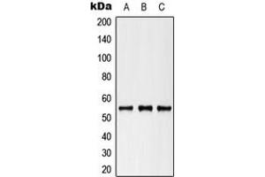 Western blot analysis of Cytokeratin 8 (pS73) expression in HeLa (A), NIH3T3 (B), H9C2 (C) whole cell lysates.
