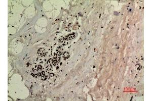 Immunohistochemistry (IHC) analysis of paraffin-embedded Human Breast, antibody was diluted at 1:100.