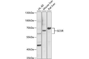 Western blot analysis of extracts of various cell lines, using GCKR Antibody (ABIN6131695, ABIN6141014, ABIN6141015 and ABIN6221331) at 1:1000 dilution. (GCKR anticorps  (AA 1-300))