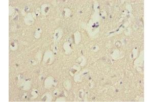 Immunohistochemistry of paraffin-embedded human brain tissue using ABIN7153074 at dilution of 1:100 (FOXN2 anticorps  (AA 172-431))