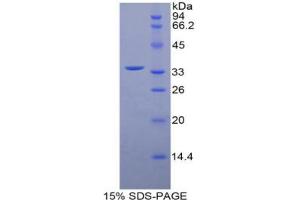 SDS-PAGE analysis of Mouse MYLK4 Protein.