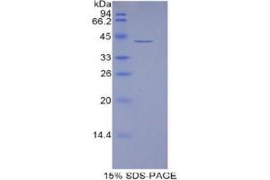 SDS-PAGE analysis of Human HIST1H2AJ Protein. (HIST1H2AJ Protéine)
