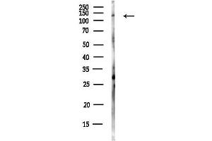 anti-DEAH (Asp-Glu-Ala-His) Box Polypeptide 37 (DHX37) antibody