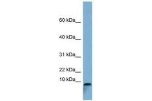 Image no. 1 for anti-T-Cell Leukemia Translocation Altered (TCTA) (C-Term) antibody (ABIN6741765) (TCTA anticorps  (C-Term))