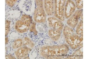 anti-Oculocerebrorenal Syndrome of Lowe (OCRL) (AA 146-239) antibody