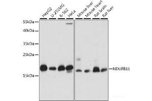 Western blot analysis of extracts of various cell lines using NDUFB11 Polyclonal Antibody at dilution of 1:1000.