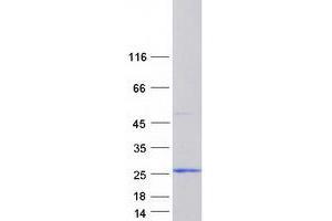 Validation with Western Blot
