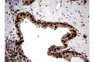 Image no. 13 for anti-Nibrin (NBN) (AA 183-460) antibody (ABIN1491058)