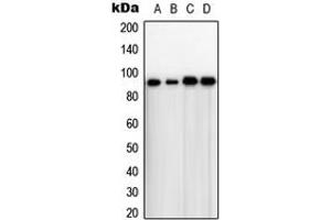 Western blot analysis of TLK1 expression in HeLa (A), A431 (B), NIH3T3 (C), rat thymus (D) whole cell lysates.
