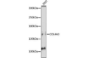 Western blot analysis of extracts of Mouse kidney, using COL4 antibody (ABIN7266460) at 1:1000 dilution. (COL4a3 anticorps  (C-Term))