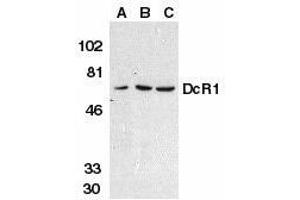 Western blot analysis of DcR1 in HeLa cell (A), mouse (B) and rat (C) liver tissue lysates with DcR1 antibody at 1μg/ml. (DcR1 anticorps)