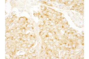 Immunohistochemistry (IHC) image for anti-Protein Kinase, CAMP-Dependent, Regulatory, Type II, alpha (PRKAR2A) (AA 50-100) antibody (ABIN7448741)