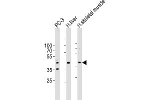 Western blot analysis of lysates from PC-3 cell line, human liver, human skeletal muscle tissue lysate(from left to right), using POC1A Antibody (C-term) ABIN6577916. (POC1A anticorps  (C-Term))