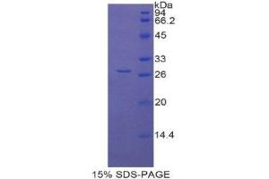 SDS-PAGE (SDS) image for Lysyl Oxidase-Like 1 (LOXL1) (AA 393-603) protein (His tag) (ABIN2125756) (LOXL1 Protein (AA 393-603) (His tag))