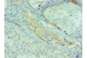 Immunohistochemistry of paraffin-embedded human testis tissue using ABIN7145198 at dilution of 1:100 (BIRC2 anticorps  (AA 1-300))