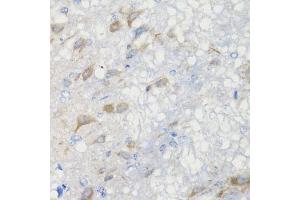 Immunohistochemistry of paraffin-embedded rat brain using CHIC2 antibody (ABIN6130103, ABIN6138533, ABIN6138534 and ABIN6223980) at dilution of 1:100 (40x lens).