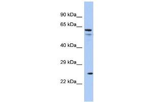 Host: Rabbit Target Name: AQP5 Sample Type: COLO205 Whole cell lysates Antibody Dilution: 1. (Aquaporin 5 anticorps  (C-Term))