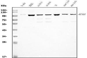 Western blot analysis of KCNQ2 using anti-KCNQ2 antibody (ABIN7601522).