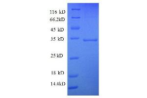 Succinate Dehydrogenase Complex, Subunit A, Flavoprotein (Fp) (SDHA) (AA 44-293), (partial) protein (GST tag)