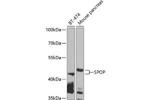 Western blot analysis of extracts of various cell lines, using SPOP antibody (ABIN6130703, ABIN6148374, ABIN6148376 and ABIN6223537) at 1:1000 dilution.