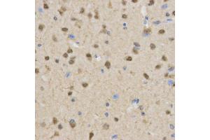Immunohistochemistry of paraffin-embedded mouse brain using TLE1 antibody at dilution of 1:200 (x400 lens).