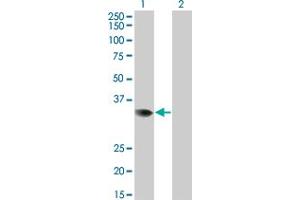 Western Blot analysis of PRPS2 expression in transfected 293T cell line by PRPS2 monoclonal antibody (M02), clone 4C1. (PRPS2 anticorps  (AA 160-269))