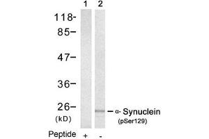 Western blot analysis of extracts from mouse brain tissue using a-Synuclein(Phospho-Ser129) Antibody(Lane 2) and the same antibody preincubated with blocking peptide(Lane1). (SNCA anticorps  (pSer129))