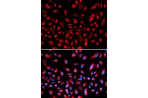 Immunofluorescence analysis of U2OS cell using CLDN11 antibody. (Claudin 11 anticorps  (AA 26-207))