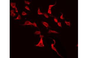 ABIN6272335 staining HeLa by IF/ICC.