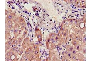 Immunohistochemistry of paraffin-embedded human liver tissue using ABIN7142182 at dilution of 1:100 (CYP39A1 anticorps  (AA 235-392))