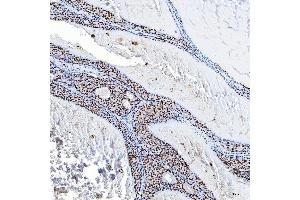 IHC analysis of SF3B3 using anti-SF3B3 antibody (ABIN7602378).