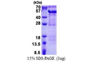SDS-PAGE (SDS) image for Debranching Enzyme Homolog 1 (DBR1) (AA 228-544) protein (His tag) (ABIN5853256)