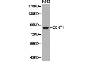 Western blot analysis of extracts of K562 cell lines, using CCNT1 antibody. (Cyclin T1 anticorps  (AA 220-320))