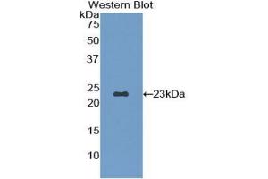 Western blot analysis of the recombinant protein. (Fibrillin 1 anticorps  (AA 168-364))