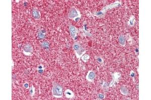 SLC25A28 antibody was used for immunohistochemistry at a concentration of 4-8 ug/ml. (SLC25A28 anticorps  (C-Term))