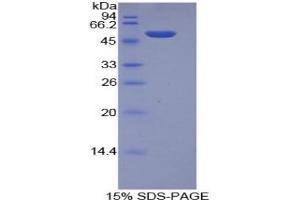 SDS-PAGE analysis of Mouse Integrin alpha 6 Protein.