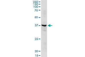 ADH1C MaxPab rabbit polyclonal antibody. (ADH1C anticorps  (AA 1-375))