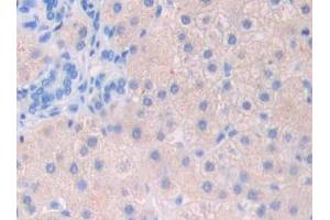 Used in DAB staining on fromalin fixed paraffin- embedded stomach cancer tissue (FIL1d anticorps  (AA 12-151))