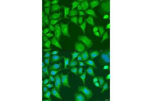 Immunofluorescence analysis of U2OS cells using SQSTM1 antibody.