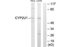 Western blot analysis of extracts from HeLa/Lovo cells, using Cytochrome P450 2U1 Antibody. (CYP2U1 anticorps  (AA 281-330))