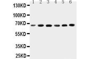 Anti-CETP antibody, Western blotting Lane 1: HELA Cell Lysate Lane 2: COLO320 Cell Lysate Lane 3:  Cell Lysate Lane 4: JURKAT Cell Lysate Lane 5: RAJI Cell Lysate Lane 6: MCF-7 Cell Lysate (CETP anticorps  (C-Term))