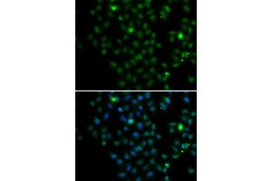 Immunofluorescence analysis of MCF-7 cells using LMO4 antibody (ABIN4904242). (LMO4 anticorps)