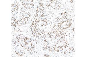 Immunohistochemistry (IHC) image for anti-Signal Transducer and Activator of Transcription 6, Interleukin-4 Induced (STAT6) (AA 600-650) antibody (ABIN7453987)