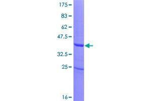 Image no. 1 for Zinc Finger Protein 343 (ZNF343) (AA 1-118) protein (GST tag) (ABIN1326121)